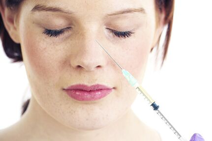 Rinoplastia no quirúrgica con rellenos