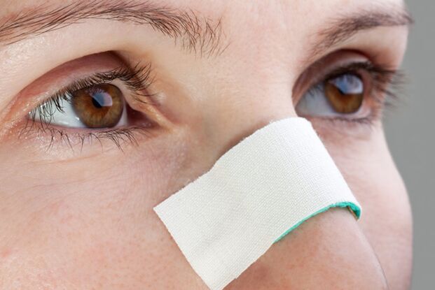 posibles complicaciones en el postoperatorio de corrección del tabique nasal